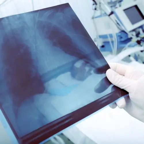 Doctor looking at an x-ray